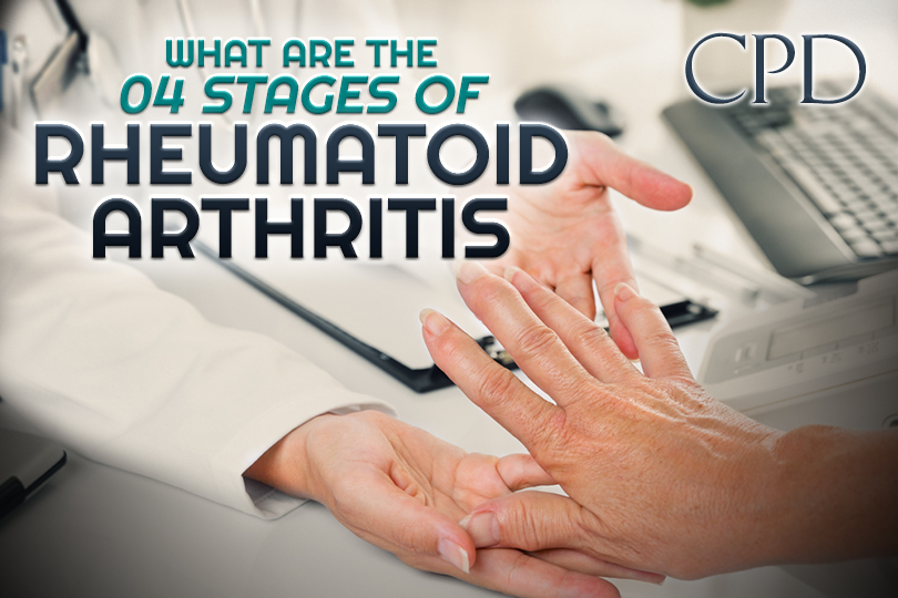 CPD – What are the 4 Stages of Rheumatoid Arthritis